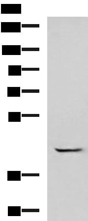 Polyclonal Rabbit anti-Human GABPB1 Antibody (IHC, WB)