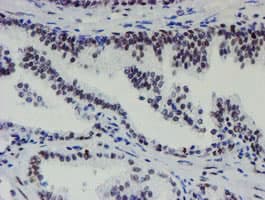 METTL16 / METT10D Antibody (clone OTI3B5)