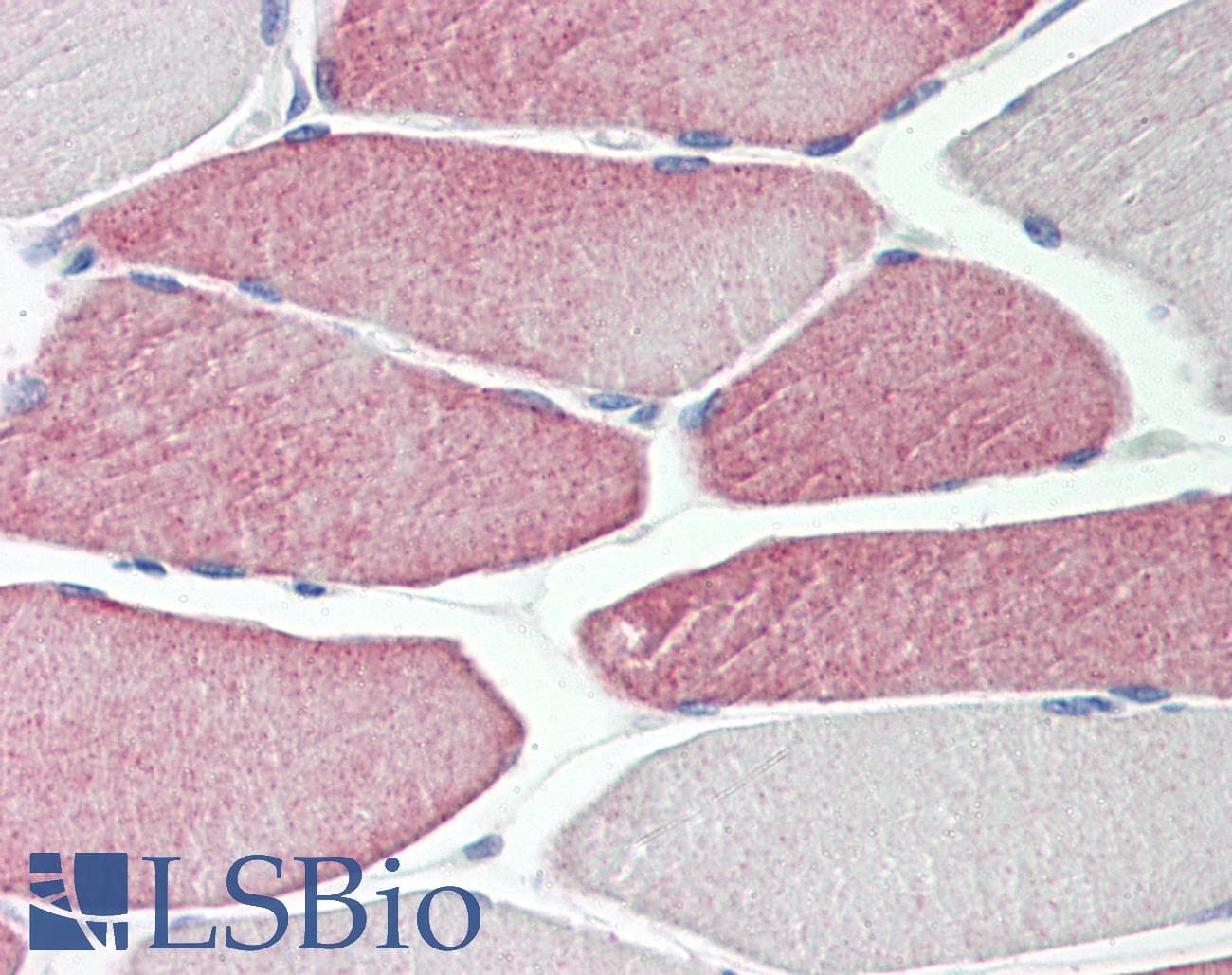 Polyclonal Rabbit anti-Human CYP2D6 Antibody (IHC, WB)