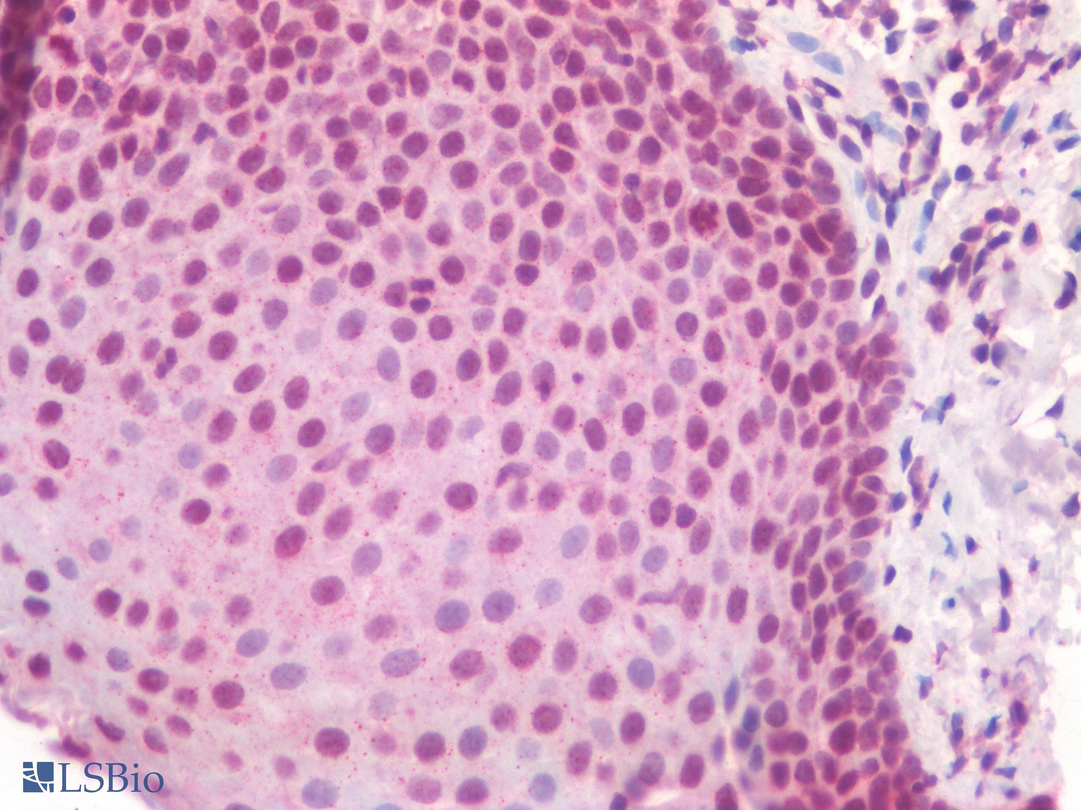 IHC-plus™ Polyclonal Rabbit anti-Human HOXA10 Antibody (IHC)