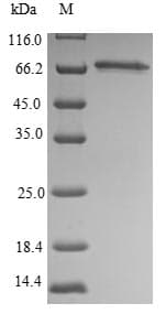 Mouse SEPT9 / Septin 9 Protein (Recombinant 6His, N-terminus)
