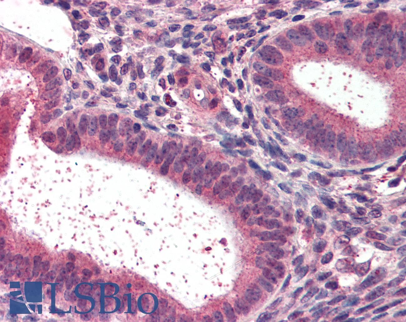 IHC-plus™ NR1H2 / LXR Beta Antibody (aa2-15)