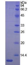 Mouse LAMB2 / Laminin Beta 2 Protein (Recombinant His, N-Terminal)