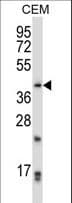Polyclonal Rabbit anti-Human PITX2 / RGS Antibody (aa42-71, WB)