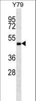 ZFYVE19 Antibody (aa387-415)