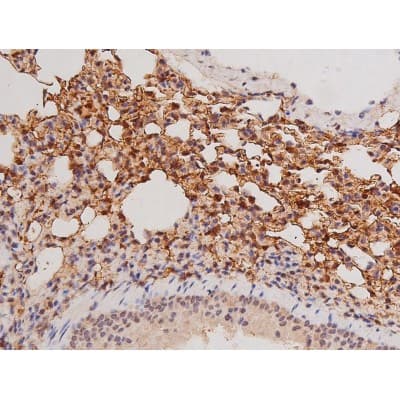 Polyclonal Rabbit anti-Human c-Kit / CD117 Antibody (IHC, IF, WB)