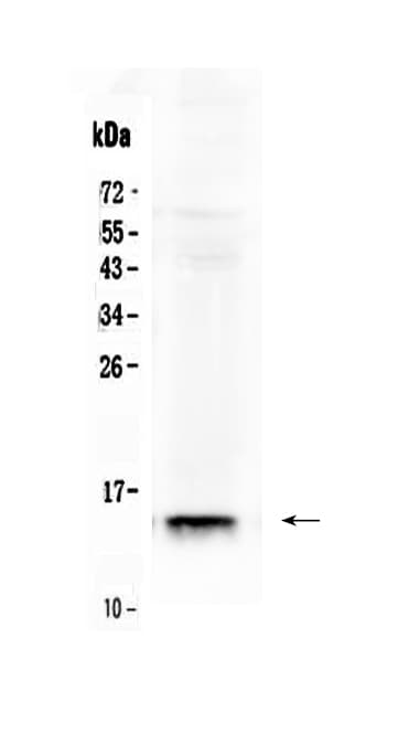 Polyclonal Rabbit anti-Mouse I-FABP / FABP2 Antibody (IHC, WB)
