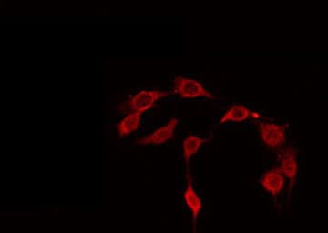 Polyclonal Rabbit anti-Human CDC37 Antibody (phospho-Ser13, IHC, IF, WB)
