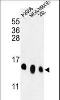 RPL36 / Ribosomal Protein L36 Antibody (aa14-42)