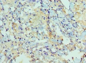 ADAM9 Antibody (aa475-685)