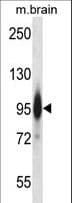 PRKCE / PKC-Epsilon Antibody (aa123-150)