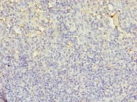 LYZ / Lysozyme Antibody (aa19-148)