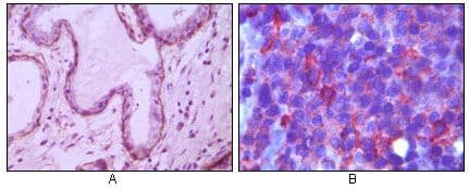 MME / CD10 Antibody (clone 2A1H5E1)