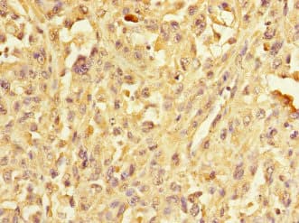 ERBB2IP / Erbin Antibody
