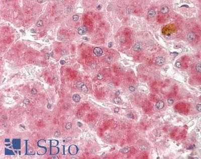 IHC-plus™ Monoclonal Mouse anti-Human TNFRSF10B / Killer / DR5 Antibody (clone HS201, IHC)