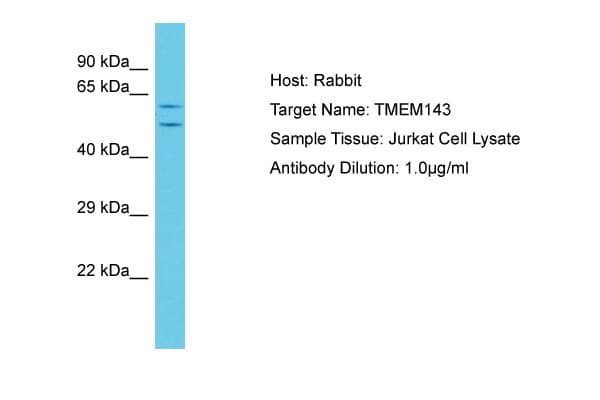 Polyclonal Rabbit anti-Human TMEM143 Antibody (C-Terminus, WB)