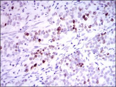 INCENP Antibody (Amino Acid: 369-583, clone 3D2)