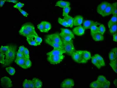 Polyclonal Rabbit anti-Human ADRBK2 / GRK3 Antibody (IHC, WB)