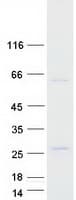 Human FOXN2 Protein (Recombinant Myc-DDK (Flag))