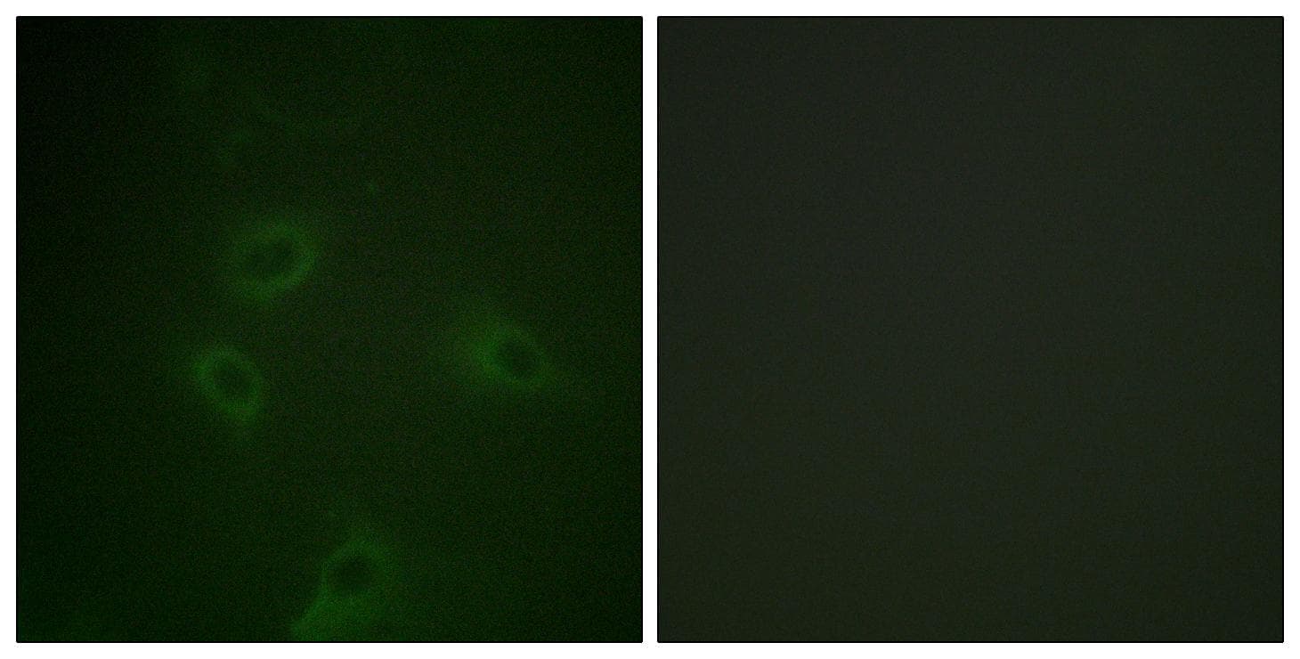 PIK3R1 / p85 Alpha Antibody (p467/199)