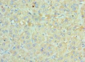 SRPK1 Antibody (aa290-480)