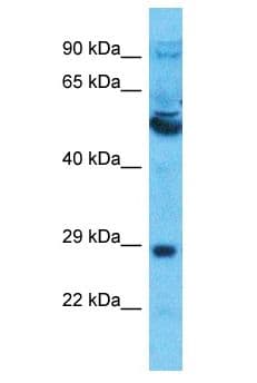 SLC13A5 Antibody (aa205-254)