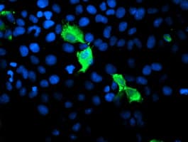 Monoclonal Mouse anti-Human GIMAP4 Antibody (clone OTI1A11, Carrier-free, IHC, IF, WB)
