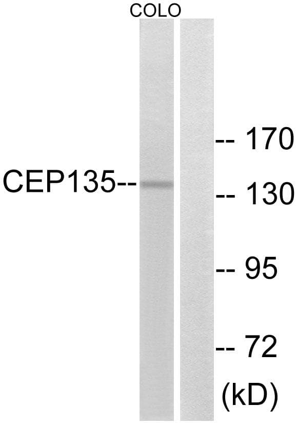 Polyclonal Rabbit anti-Human CEP135 Antibody (WB)
