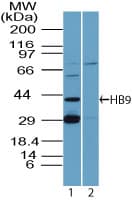 MNX1 / HB9 Antibody (aa330-380)