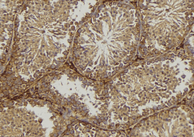 Polyclonal Rabbit anti-Human CTSK / Cathepsin K Antibody (IHC, IF, WB)