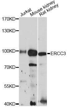 ERCC3 / XPB Antibody
