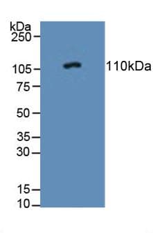 PTPRN / IA-2 Antibody (aa368-575)