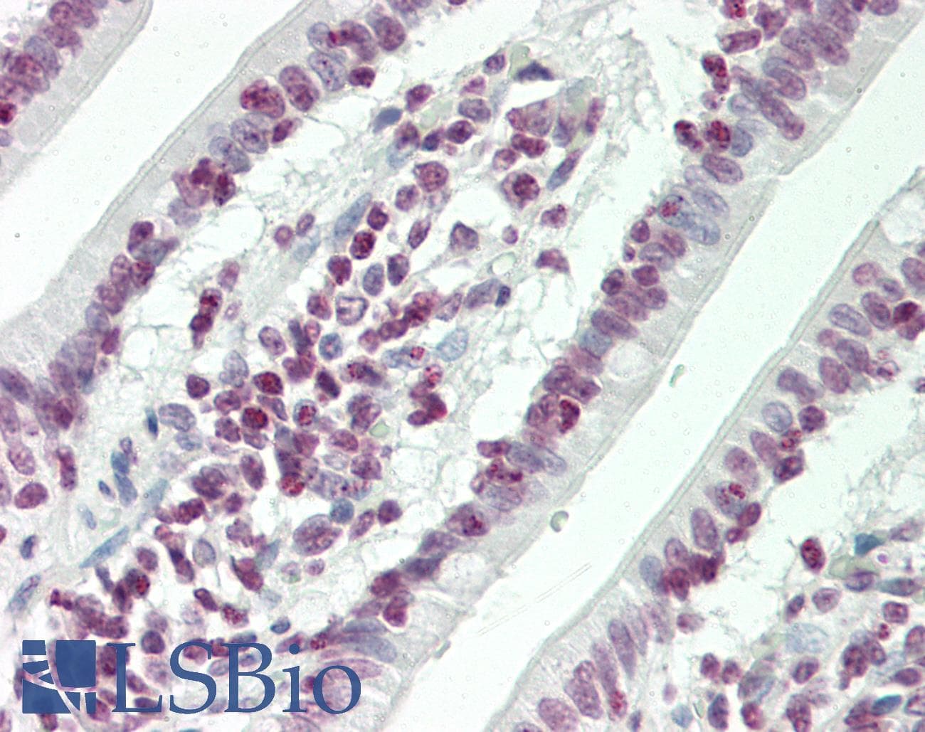 IHC-plus™ Polyclonal Rabbit anti-Human HOXC4 Antibody (aa197-225, IHC, WB)