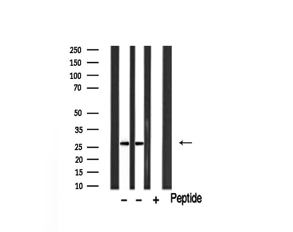 GZMB / Granzyme B Antibody