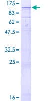 Human CPT1C Protein (Recombinant GST)