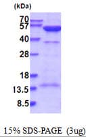 Human PRKAR2A Protein (Recombinant His)