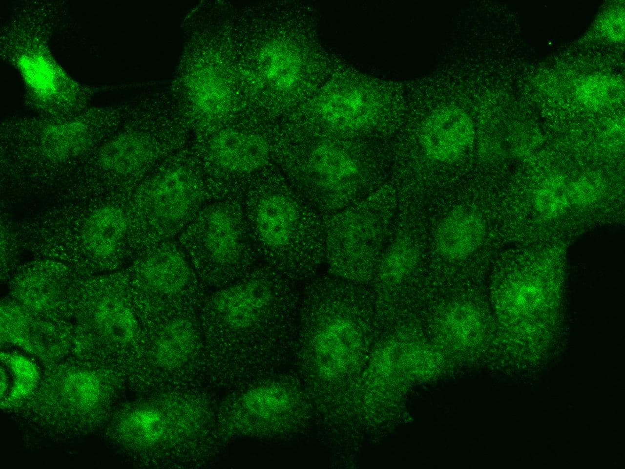 Polyclonal Rabbit anti-Human THRSP Antibody (IHC, IF)