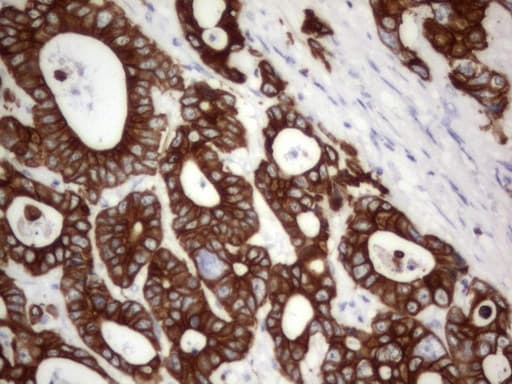 Acidic Cytokeratin Antibody (clone 3E10)