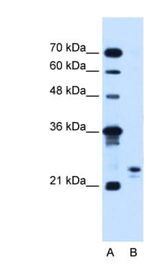 MOSPD3 Antibody (C-Terminus, FITC)