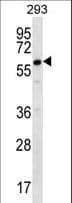 Polyclonal Rabbit anti-Human DAZ2 Antibody (aa518-546, WB)