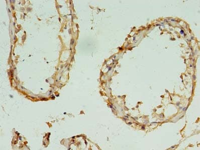RBM11 Antibody