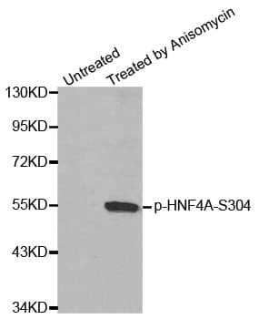 HNF4A / HNF4 Antibody (phospho-Ser304)