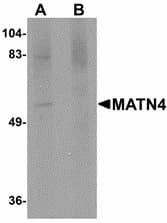 Polyclonal Rabbit anti-Human MATN4 / Matrilin 4 Antibody (IHC, IF, WB)