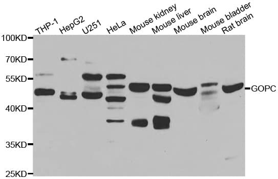 Polyclonal Rabbit anti-Human GOPC / PIST Antibody (IHC, IF, WB)