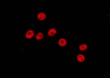 Polyclonal Rabbit anti-Human GTF3C3 Antibody (IF, WB)