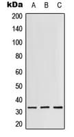 RPS3 / Ribosomal Protein S3 Antibody (C-Terminus)