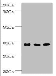 Polyclonal Rabbit anti-Human M-PST / STM Antibody (aa1-295, IHC, WB)