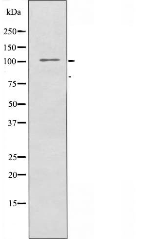NCAPG / HCAP-G Antibody