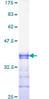 Human CBFA1 / RUNX2 Protein (Recombinant GST, N-terminus)