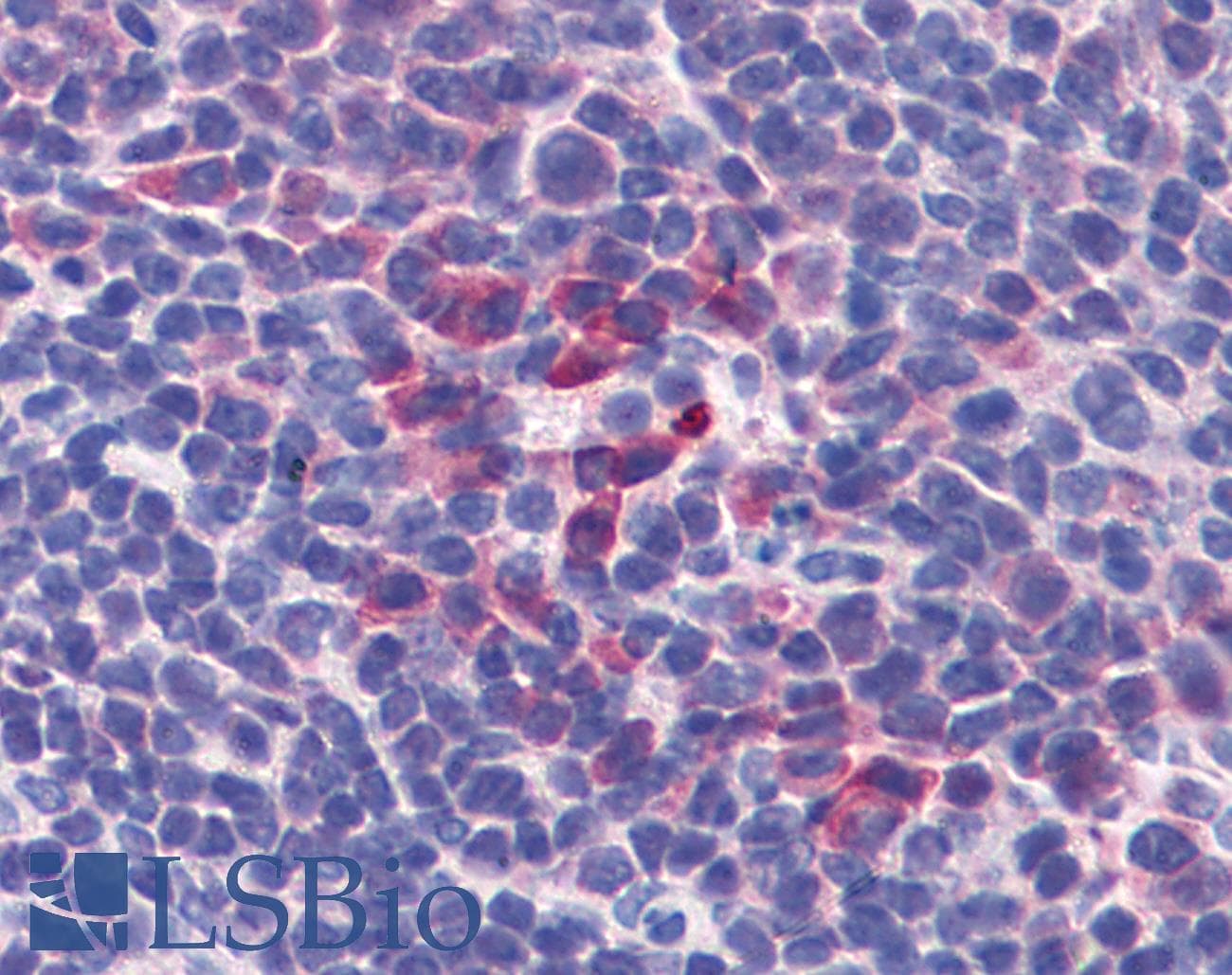 PathPlus™ IL-10 Antibody (clone JES5-2A5)